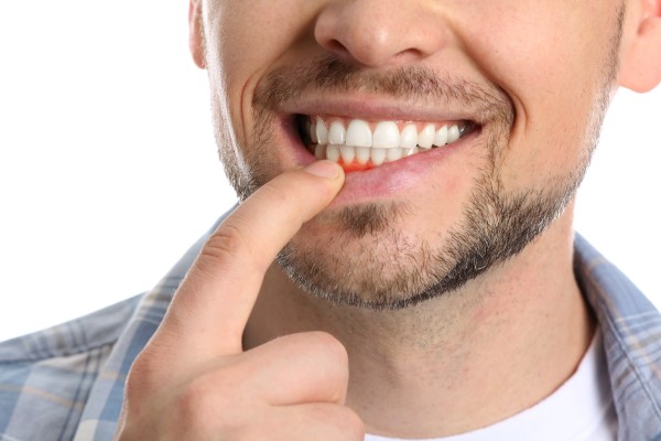 Benefits Of Gum Disease Treatment From A Dentist